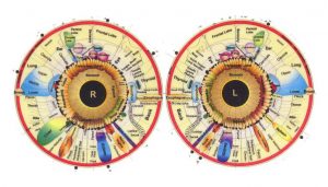 Irisdiagnostik