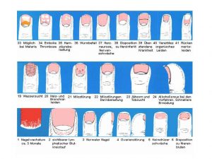 Nageldiagnostik