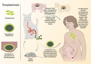 Toxoplasmose